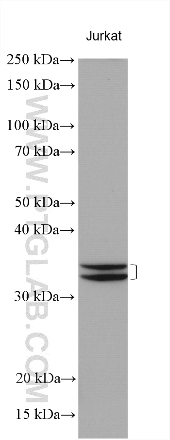 WB analysis using 17511-1-AP