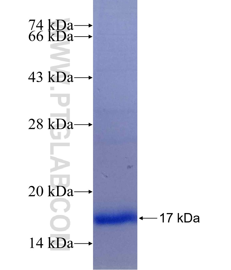 ICMT fusion protein Ag14981 SDS-PAGE