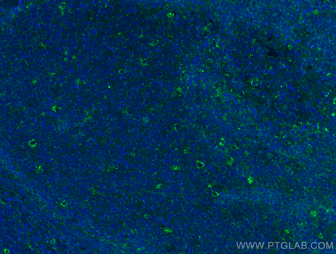 IF Staining of human tonsillitis using 13338-1-AP