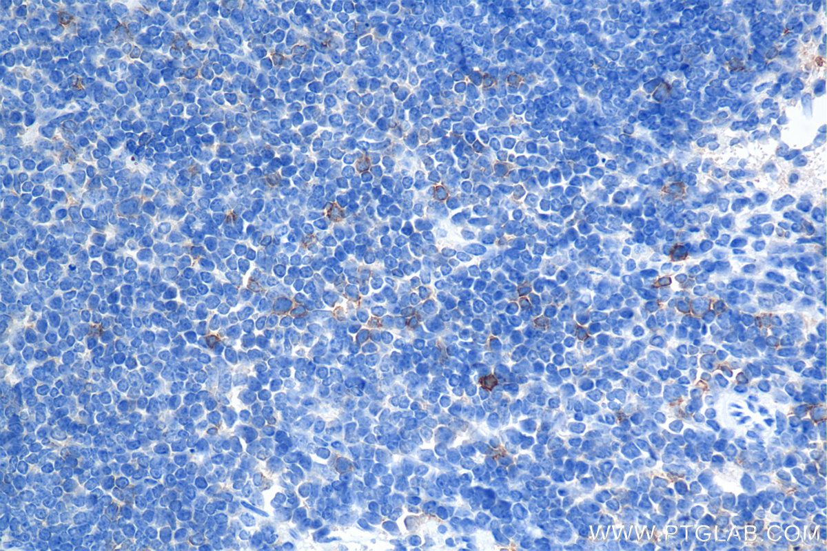 Immunohistochemical analysis of paraffin-embedded mouse spleen tissue slide using <a class='green' href='/productredirect?CatalogNo=85035-2-RR' target='_blank'>85035-2-RR</a> (ICOS/CD278 antibody) at dilution of 1:1000 (under 40x lens). Heat mediated antigen retrieval with Tris-EDTA buffer (pH 9.0). This data was developed using the same antibody clone with 85035-2-PBS in a different storage buffer formulation. IHC staining of mouse spleen using 85035-2-RR (same clone as 85035-2-PBS)