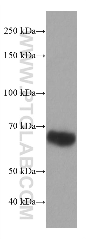 ICOSLG/B7-H2/CD275