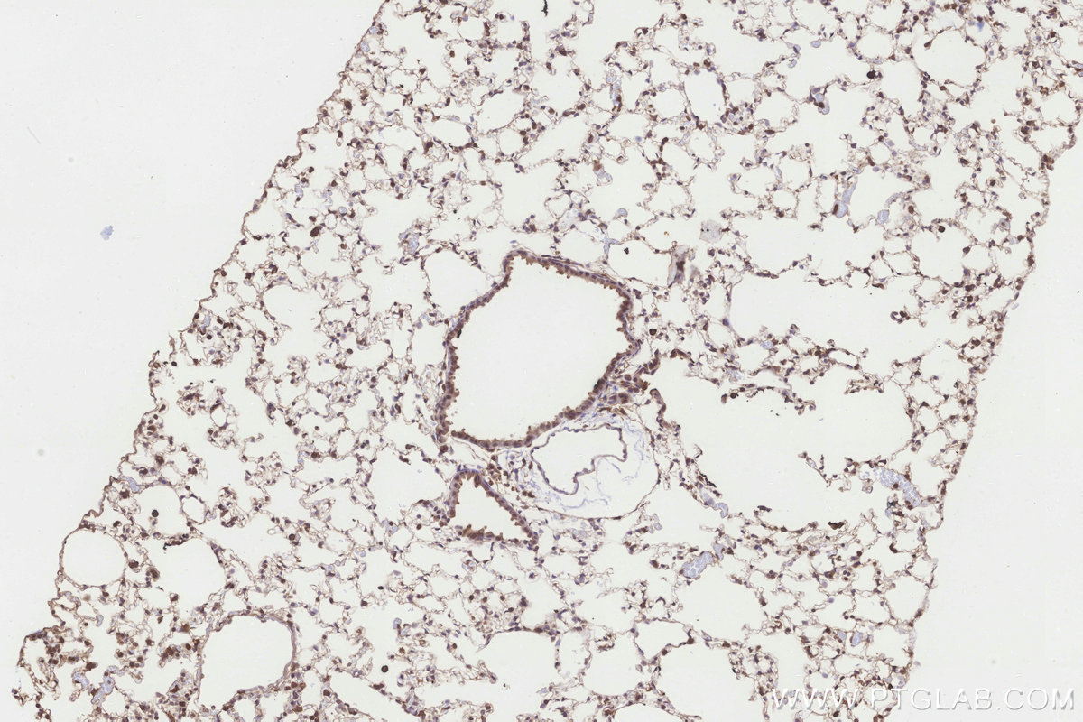 IHC staining of mouse lung using 10403-1-AP IHC staining of mouse lung using 10403-1-AP