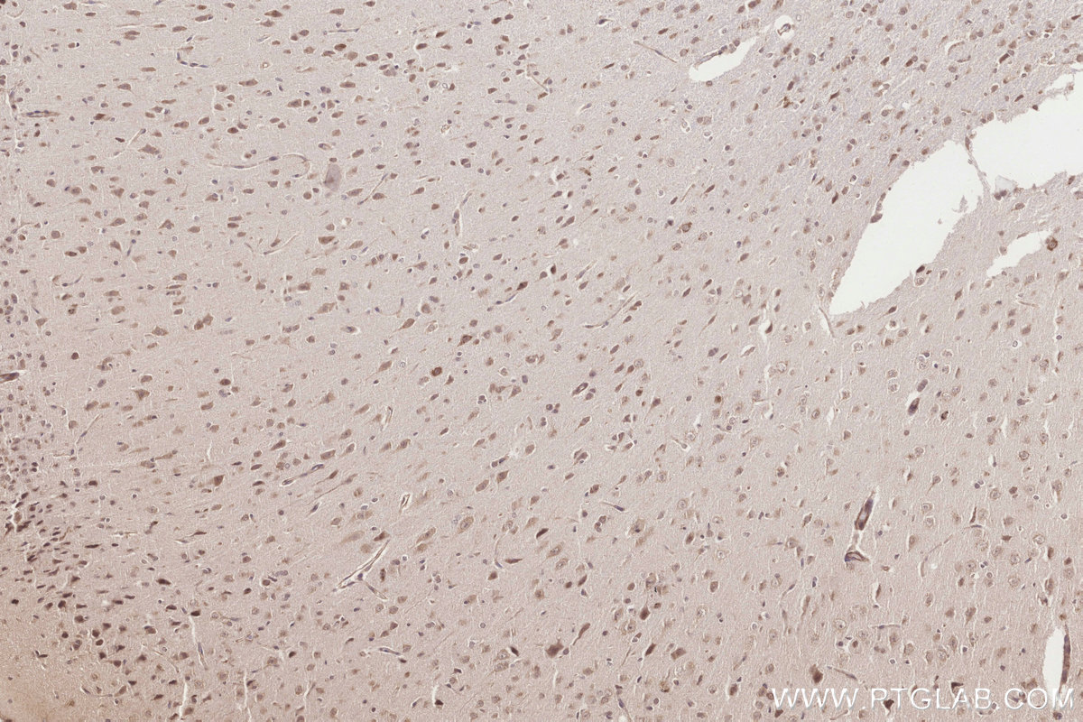 IHC staining of rat brain using 10403-1-AP IHC staining of rat brain using 10403-1-AP