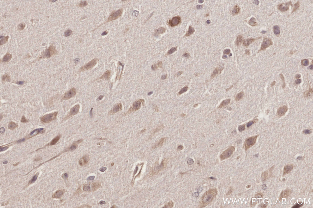 IHC staining of rat brain using 10403-1-AP