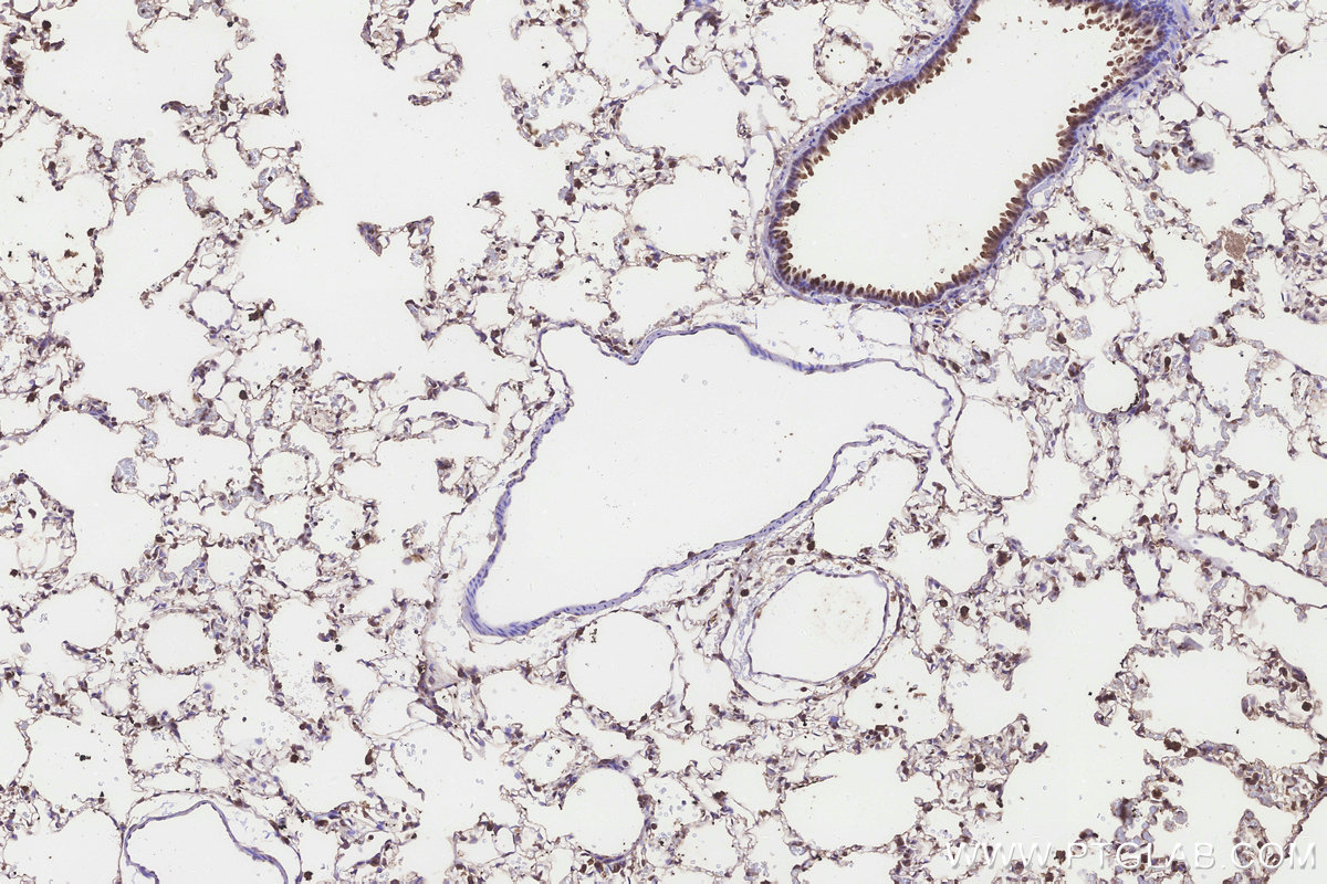 IHC staining of rat lung using 10403-1-AP IHC staining of rat lung using 10403-1-AP