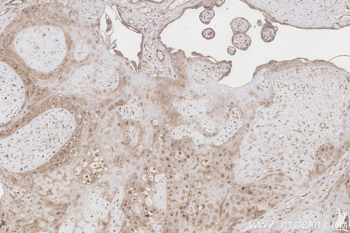 IHC staining of human placenta using 10403-1-AP IHC staining of human placenta using 10403-1-AP