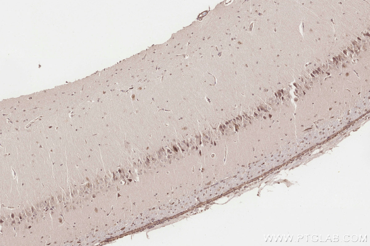 IHC staining of rat brain using 10403-1-AP IHC staining of rat brain using 10403-1-AP