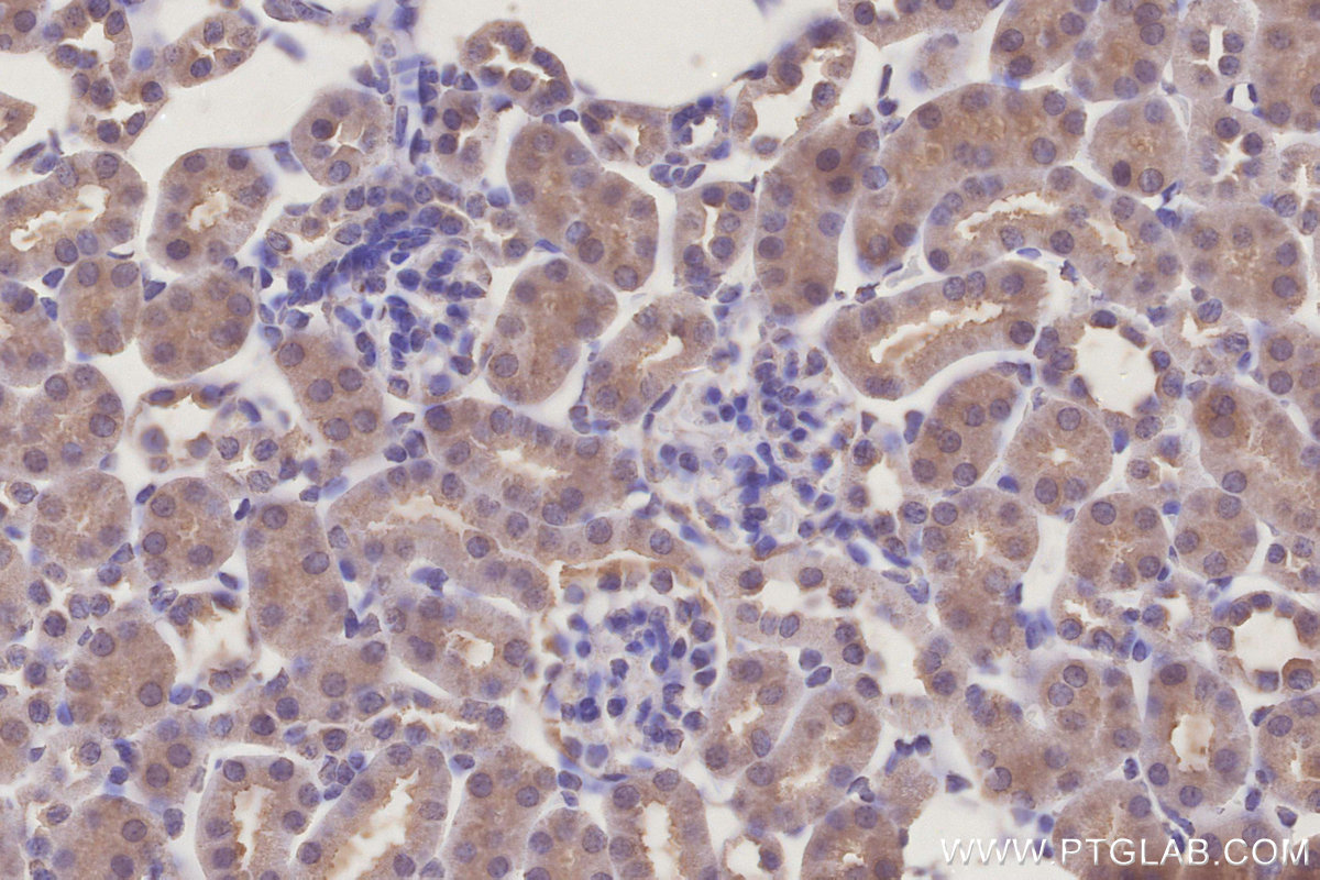 IHC staining of mouse kidney using 68898-3-Ig (same clone as 68898-3-PBS) IHC staining of mouse kidney using 68898-3-Ig (same clone as 68898-3-PBS)