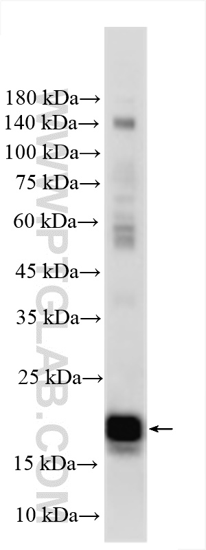 WB analysis using 18475-1-AP