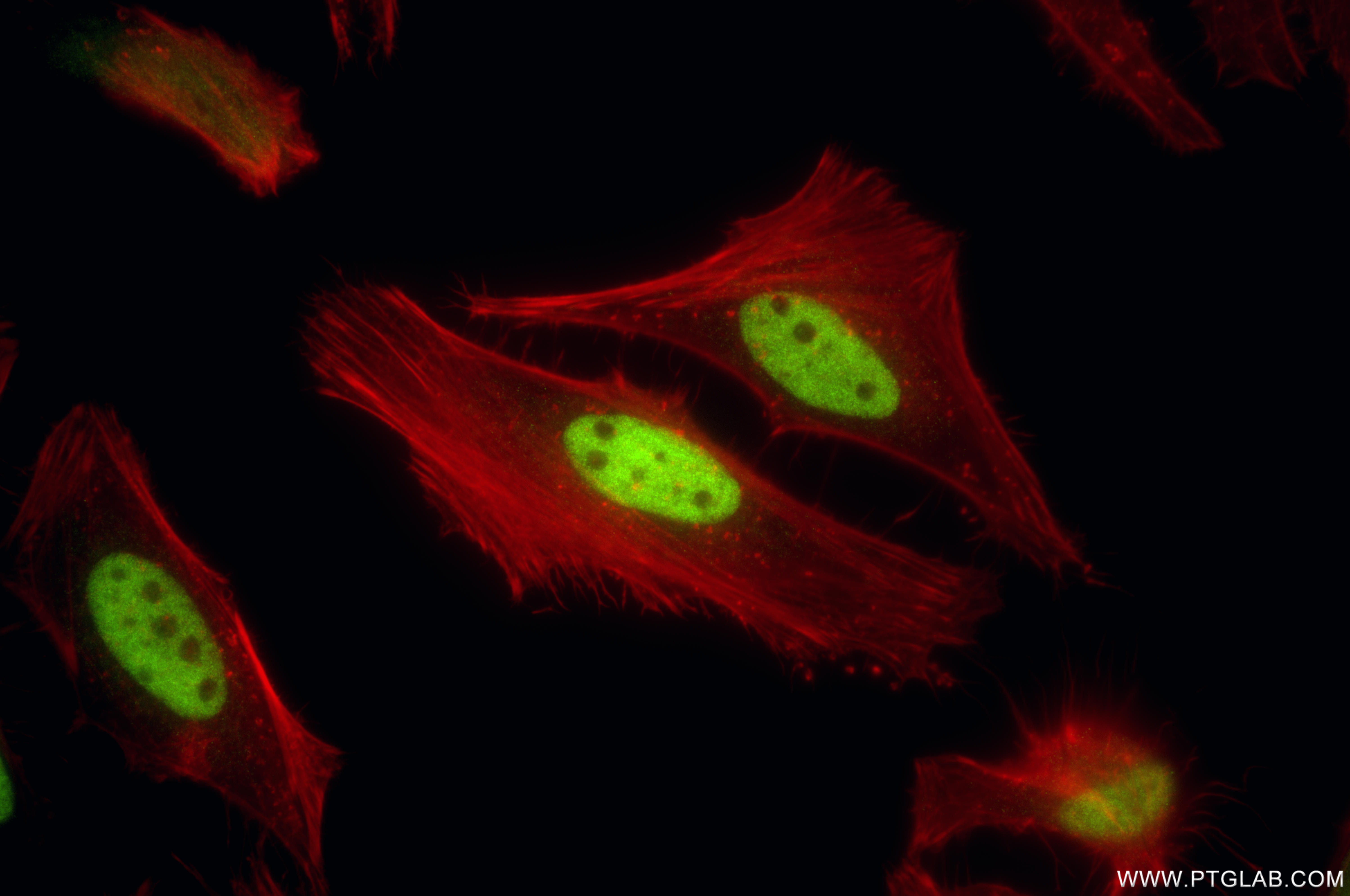 IF Staining of HeLa using 86979-1-RR IF Staining of HeLa using 86979-1-RR