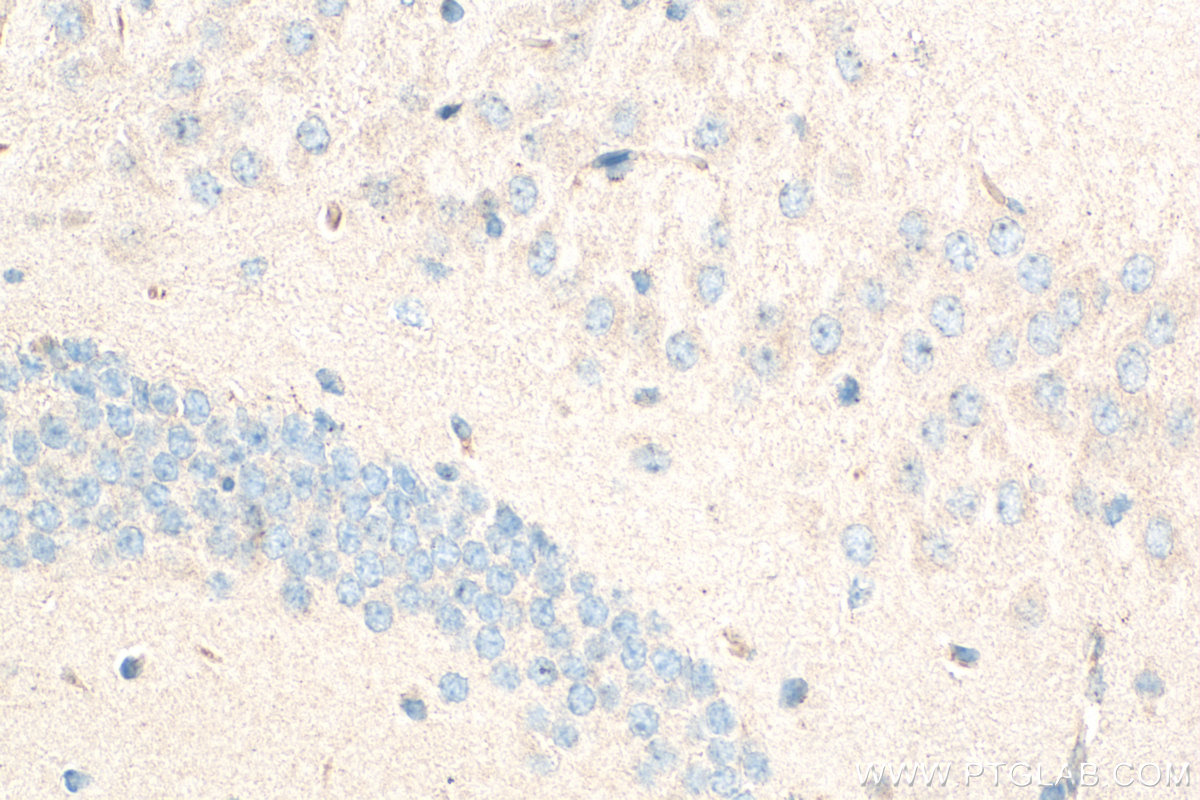 Immunohistochemical analysis of paraffin-embedded mouse brain tissue slide using 21728-1-AP (IDE antibody) at dilution of 1:200 (under 40x lens). Heat mediated antigen retrieval with Tris-EDTA buffer (pH 9.0). IHC staining of mouse brain using 21728-1-AP
