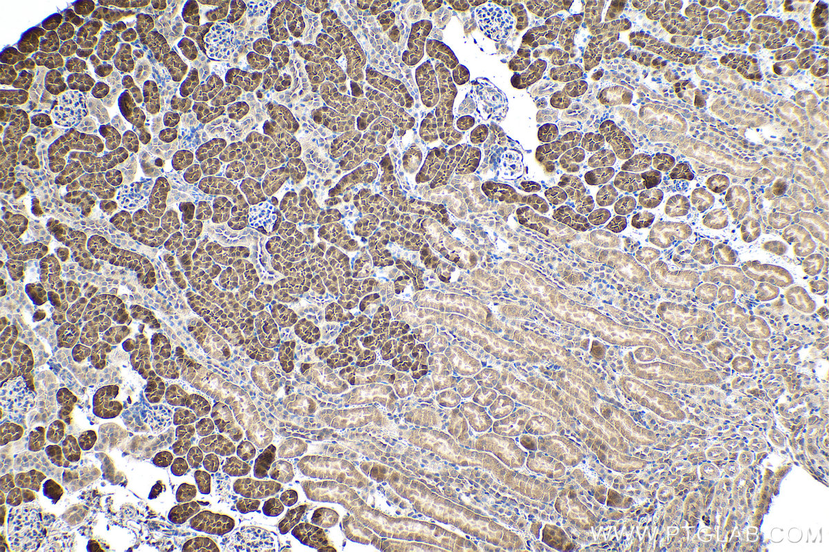 IHC staining of mouse kidney using 23309-1-AP