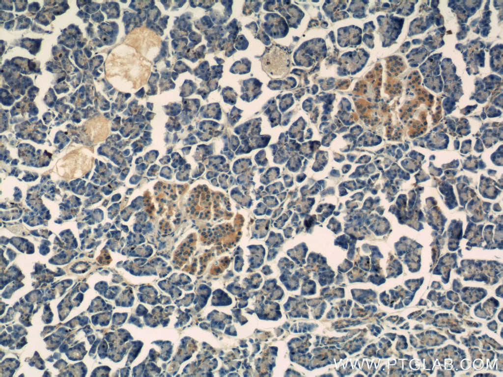 IHC staining of human pancreas using 66197-1-Ig (same clone as 66197-1-PBS)