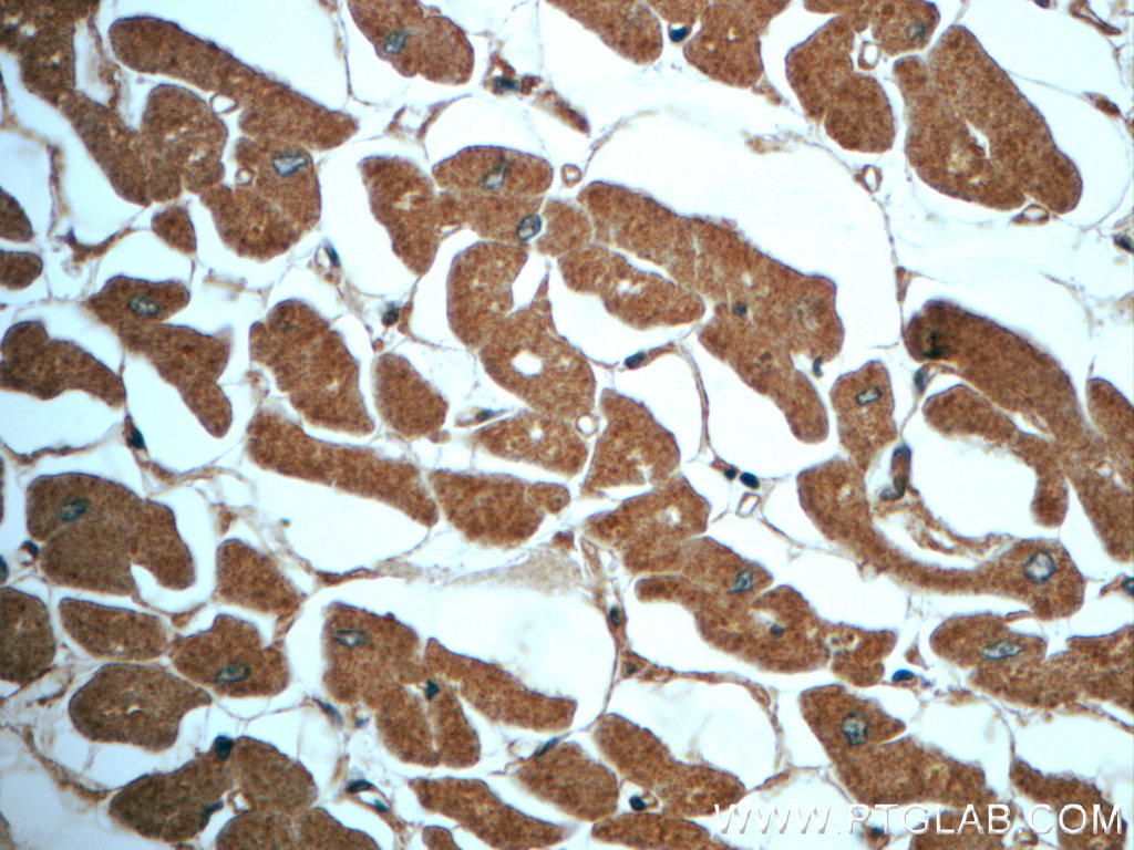 IHC staining of human heart using 23254-1-AP