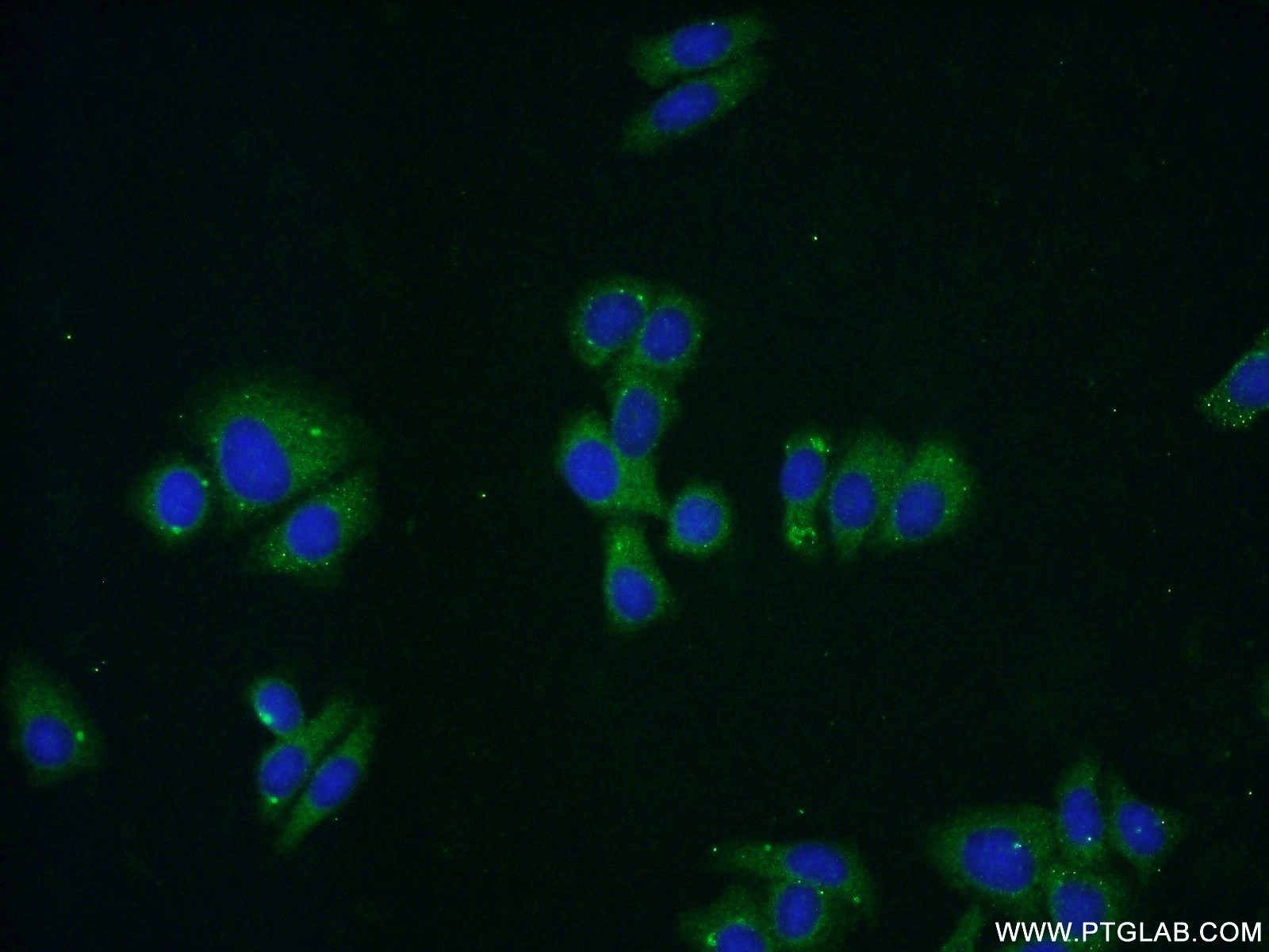 IF Staining of HepG2 using 15909-1-AP