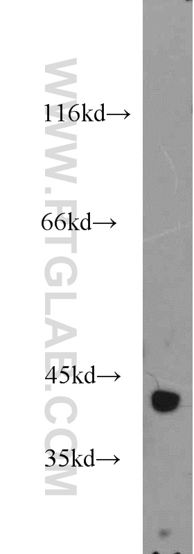 WB analysis of human skeletal muscle using 15909-1-AP