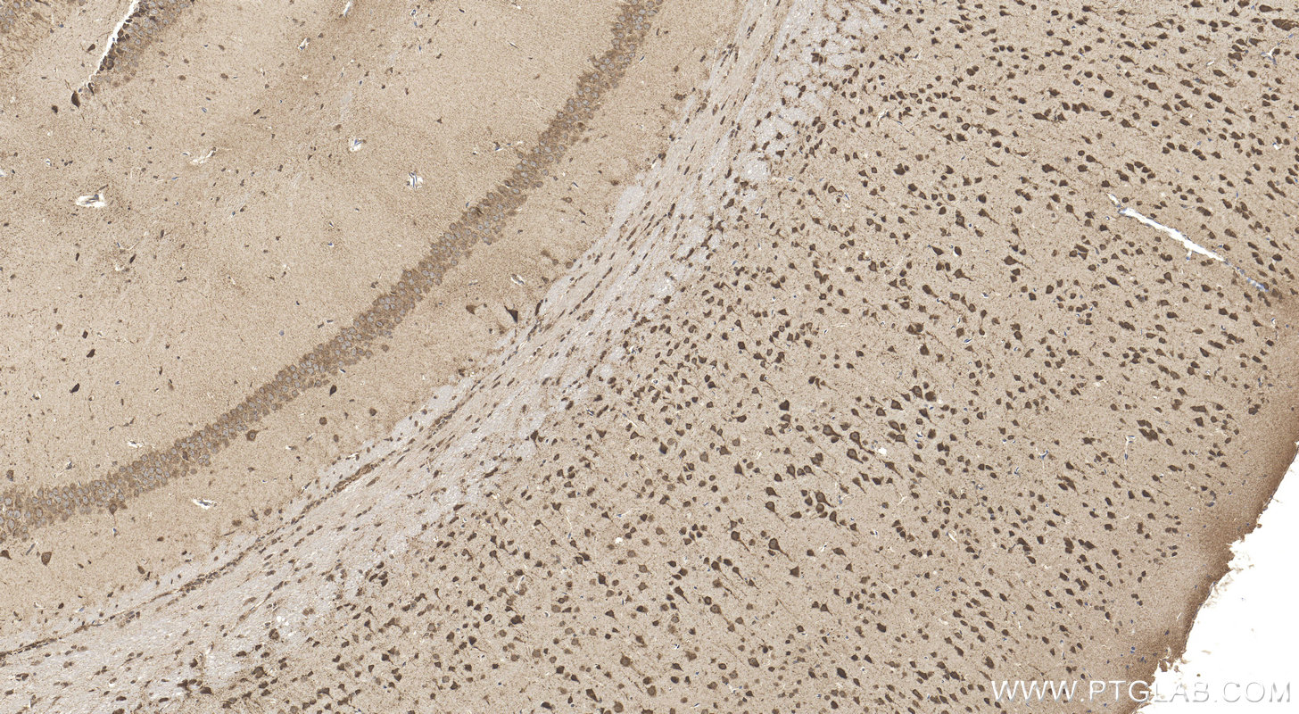 IHC staining of mouse brain using 15576-1-AP