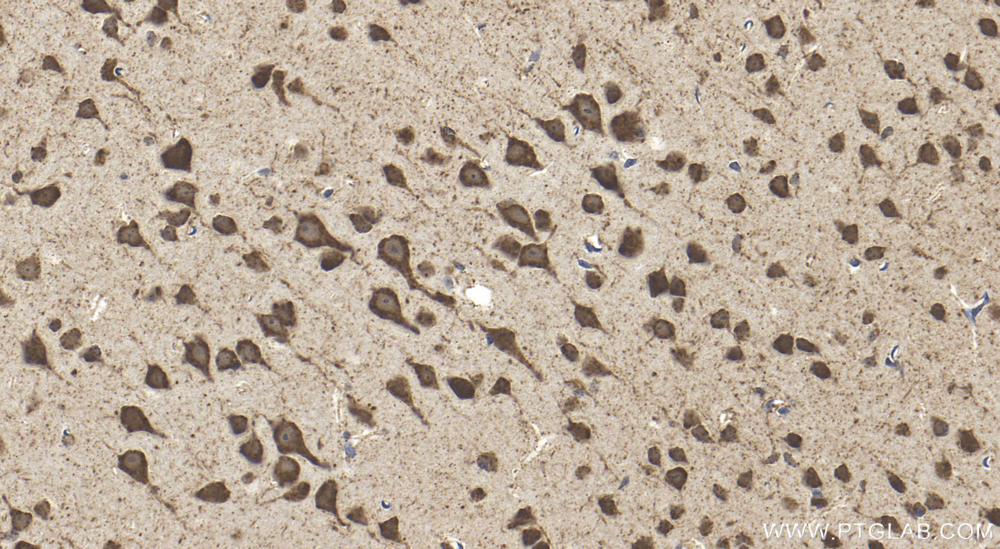 IHC staining of mouse brain using 15576-1-AP