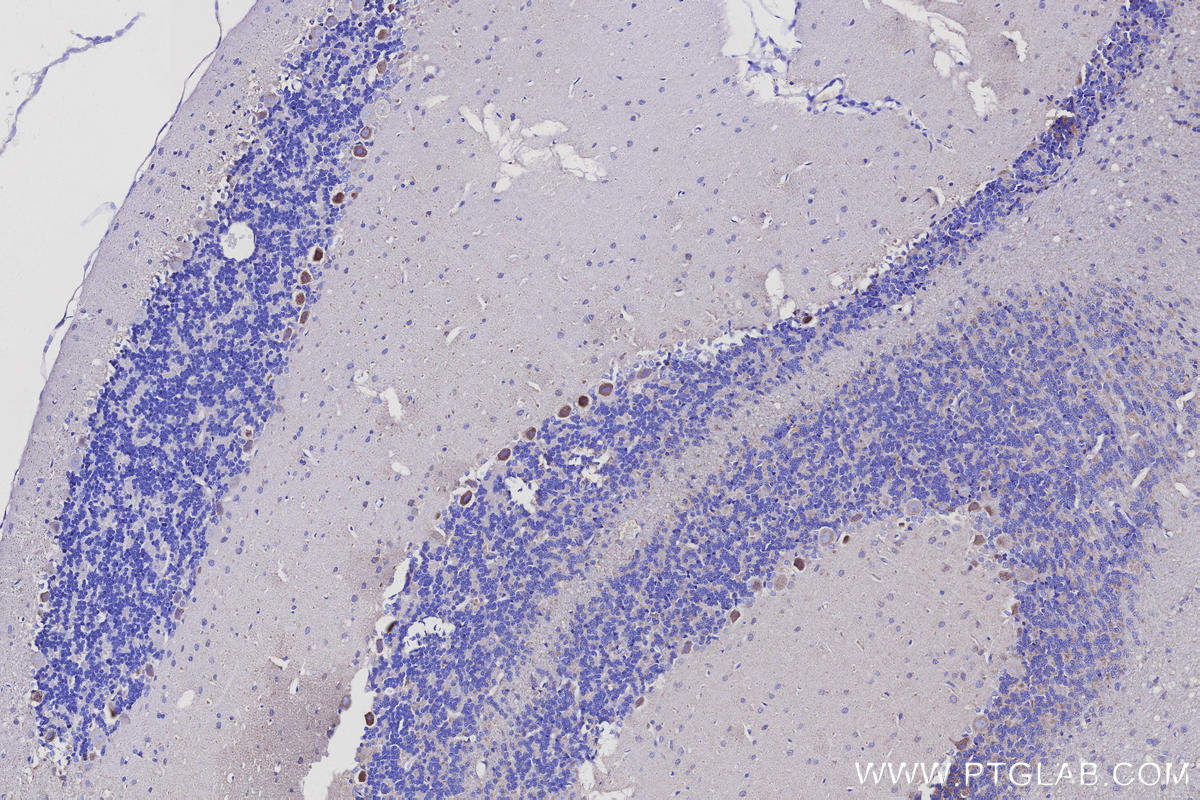 IHC staining of rat cerebellum using 68199-1-Ig IHC staining of rat cerebellum using 68199-1-Ig