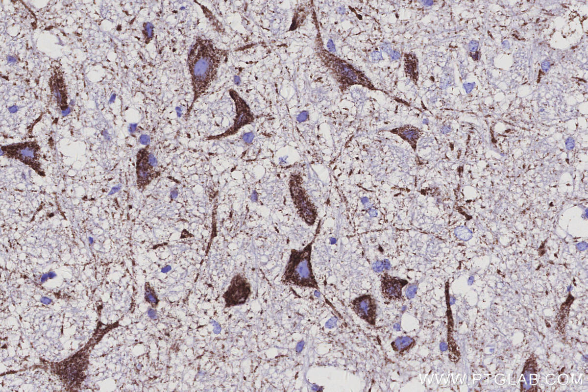 IHC staining of mouse cerebellum using 68199-1-Ig IHC staining of mouse cerebellum using 68199-1-Ig