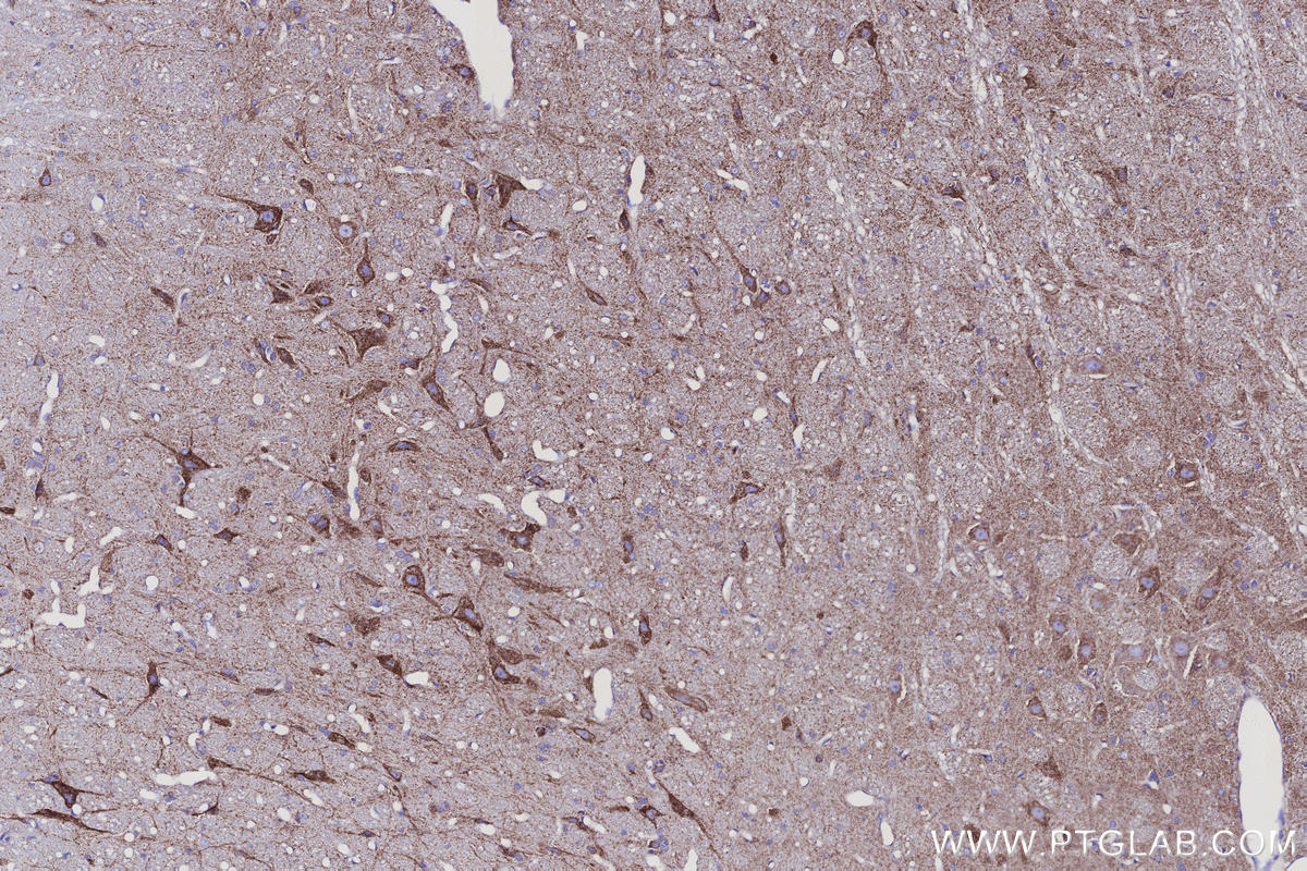 IHC staining of rat cerebellum using 68199-1-Ig IHC staining of rat cerebellum using 68199-1-Ig