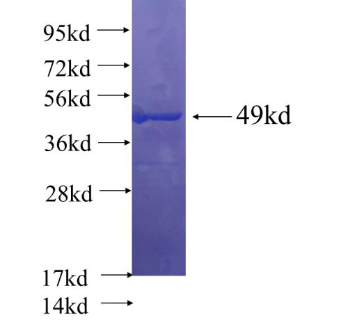 IDH3G fusion protein Ag23113 SDS-PAGE