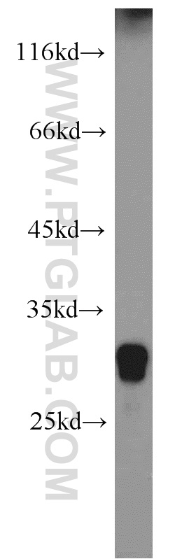 WB analysis of human skeletal muscle using 16701-1-AP