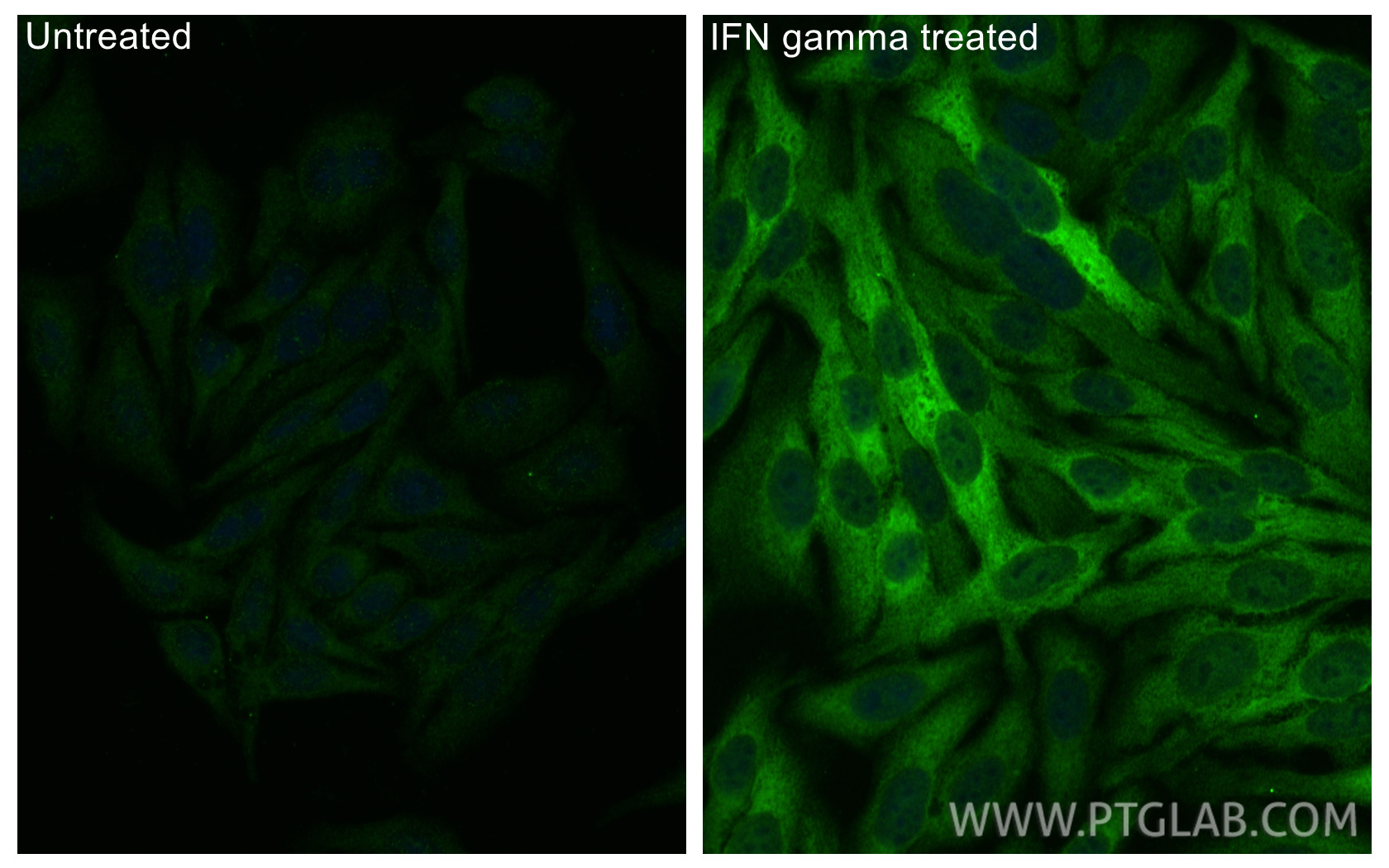 IF Staining of HepG2 using 13268-1-AP IF Staining of HepG2 using 13268-1-AP