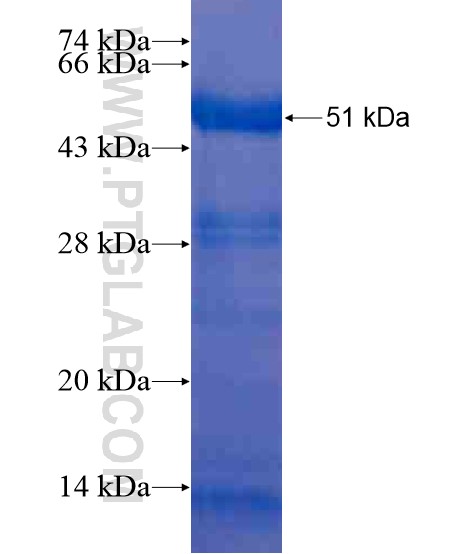 IDO1 fusion protein Ag21102 SDS-PAGE IDO1 fusion protein Ag21102 SDS-PAGE