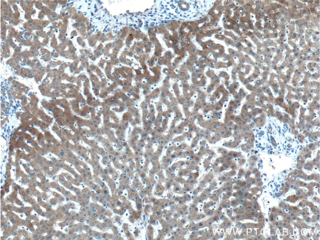 IHC staining of human liver using 25053-1-AP