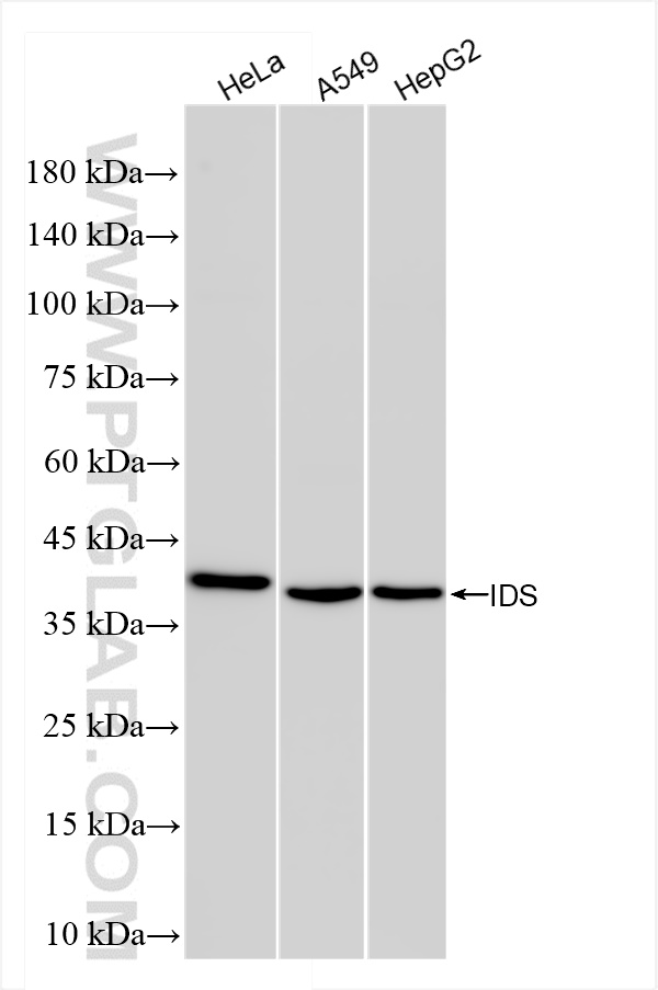 WB analysis using 84623-6-RR