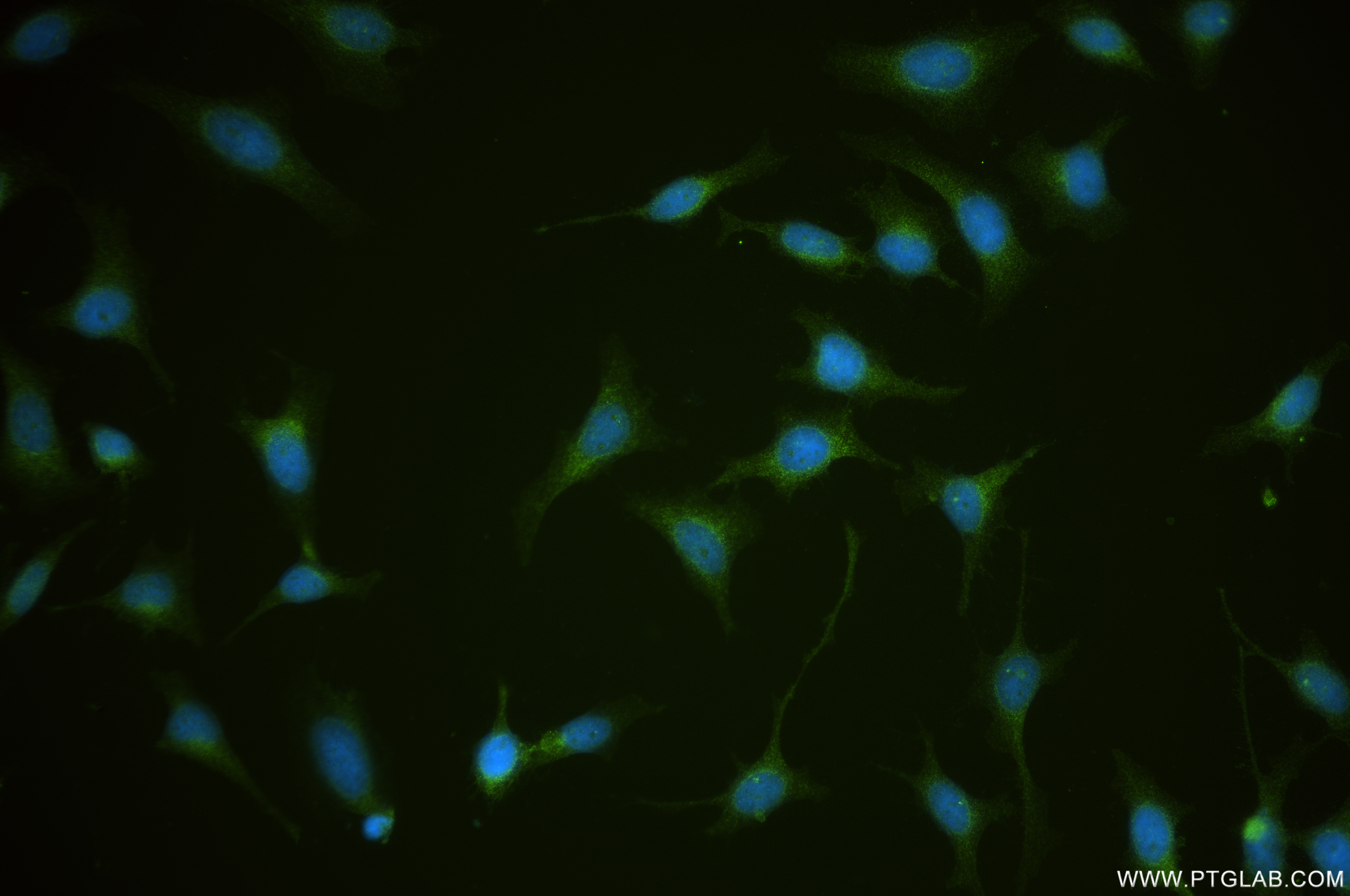 IF Staining of HeLa using 84623-7-RR
