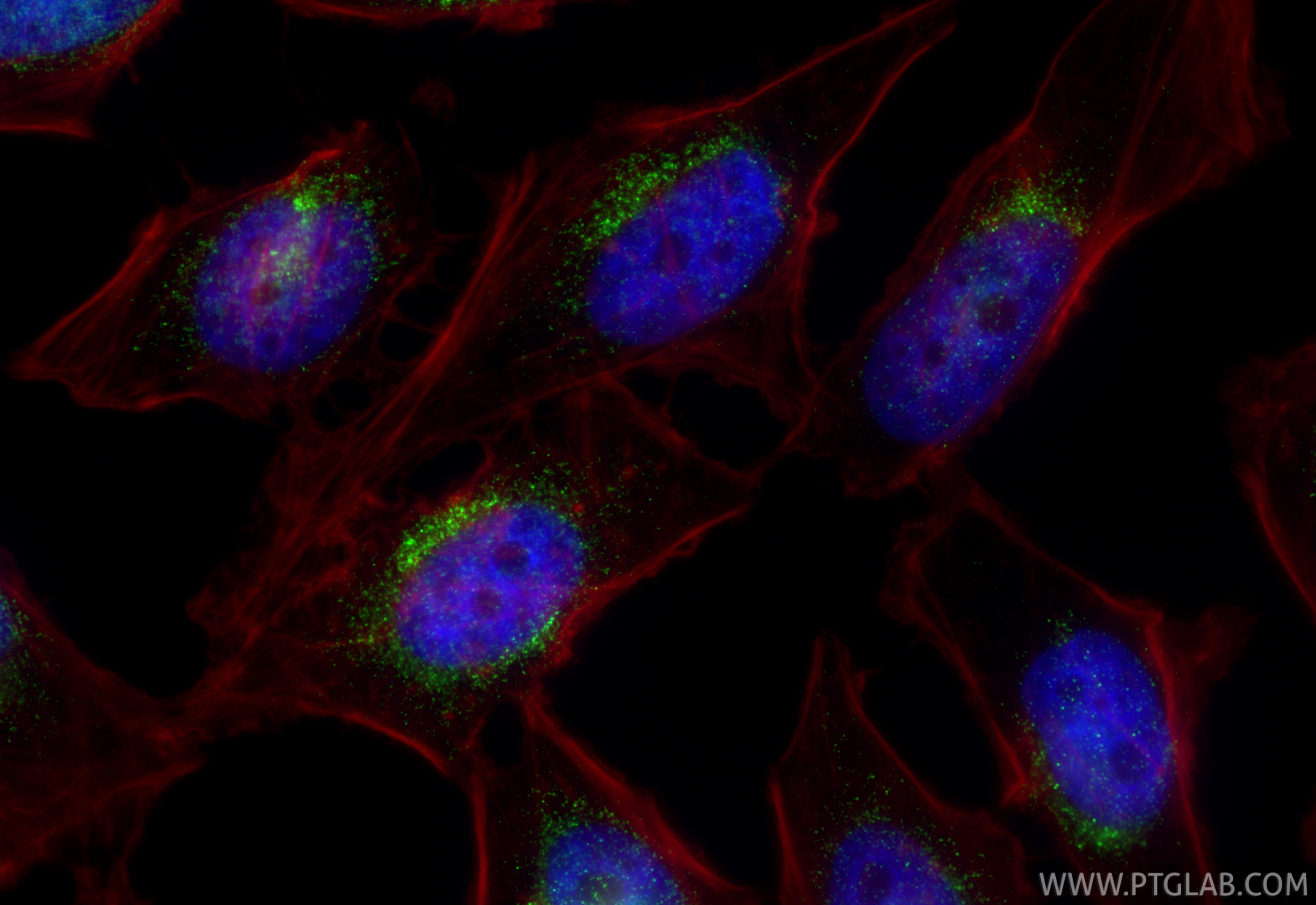 IF Staining of HeLa using 84623-7-RR IF Staining of HeLa using 84623-7-RR