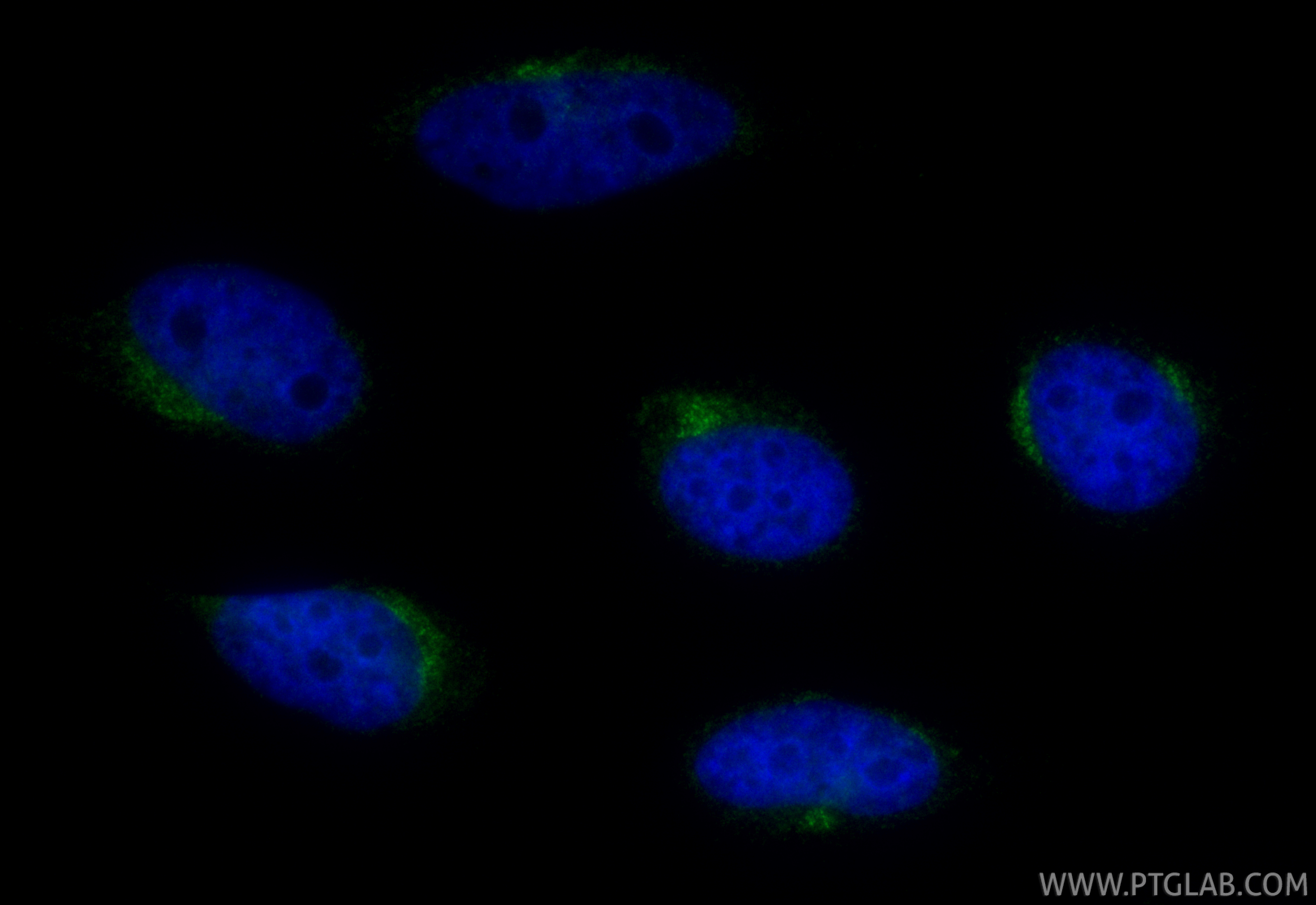IF Staining of HeLa using CL488-84623-7 IF Staining of HeLa using CL488-84623-7