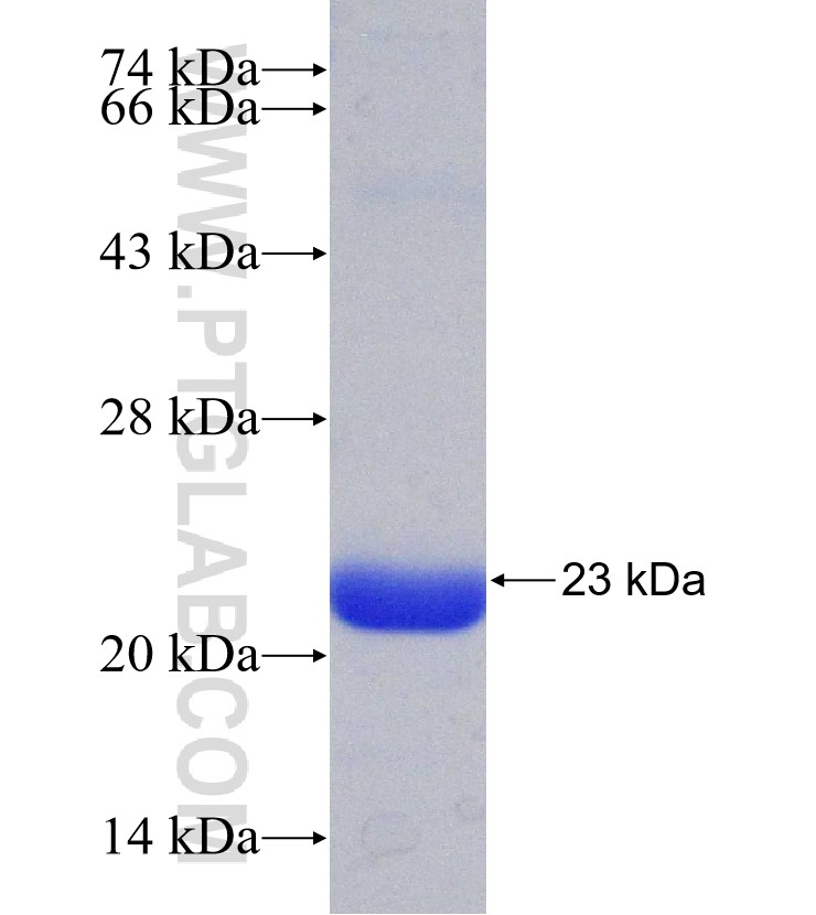 IDS fusion protein Ag31155 SDS-PAGE
