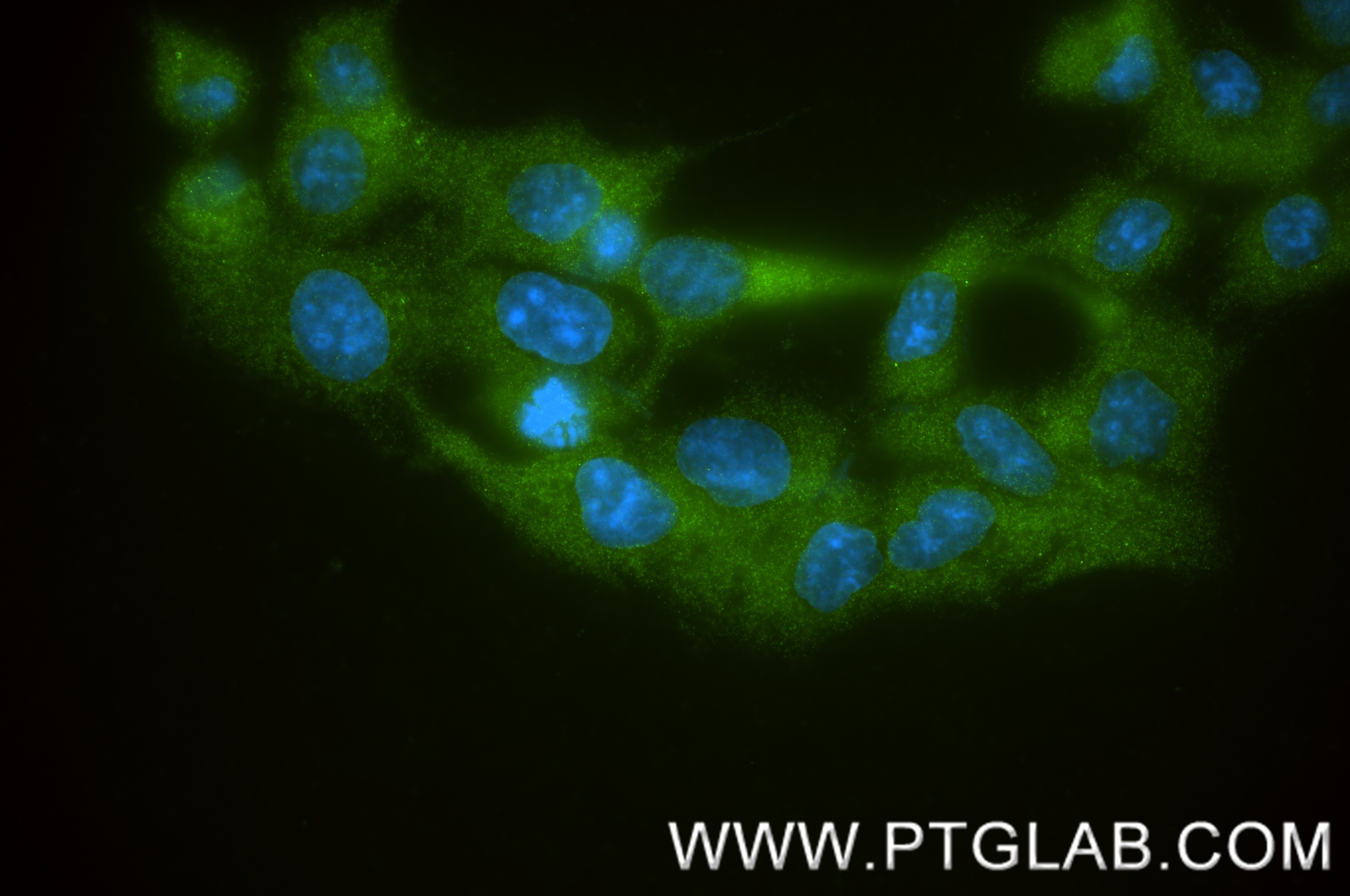 IF Staining of LNCaP using 86499-1-RR IF Staining of LNCaP using 86499-1-RR