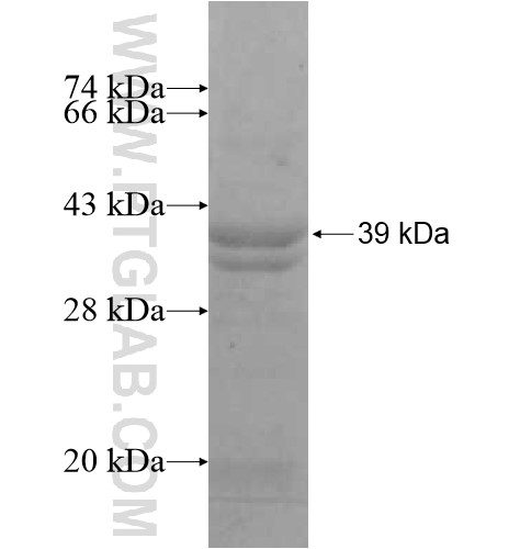 IER3 fusion protein Ag12972 SDS-PAGE IER3 fusion protein Ag12972 SDS-PAGE