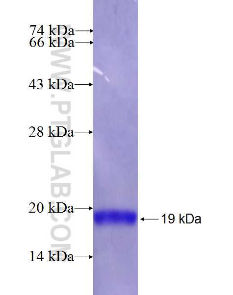 IER5 fusion protein Ag26608 SDS-PAGE IER5 fusion protein Ag26608 SDS-PAGE