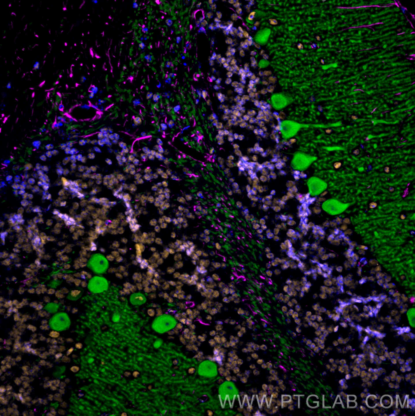 Immunofluorescence of mouse cerebellum: FFPE mouse cerebellum sections were stained with anti-Calbindin antibody (14479-1-AP, green) labeled with FlexAble HRP Antibody Labeling Kit for Rabbit IgG (KFA005) and Tyramide-488, anti-FUS antibody (68262-1-Ig, orange) labeled with FlexAble HRP Antibody Labeling Kit for Mouse IgG1 (KFA025) and Tyramide-555, and anti-GFAP antibody (60190-1-Ig, magenta) labeled with FlexAble HRP Antibody Labeling Kit for Mouse IgG2a (KFA045) and Tyramide-650. Cell nuclei are in blue.