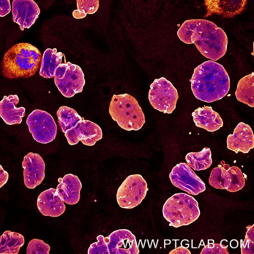 Immunofluorescence of A431 cells: PFA-fixed cells were stained with anti-Lamin B1 (12987-1-AP) labeled with FlexAble CoraLite® Plus 594 Kit (KFA009, orange) and DAPI (blue). ​

Confocal images were acquired with a 63x oil objective and post-processed. Images were recorded at the Core Facility Bioimaging at the Biomedical Center, LMU Munich.