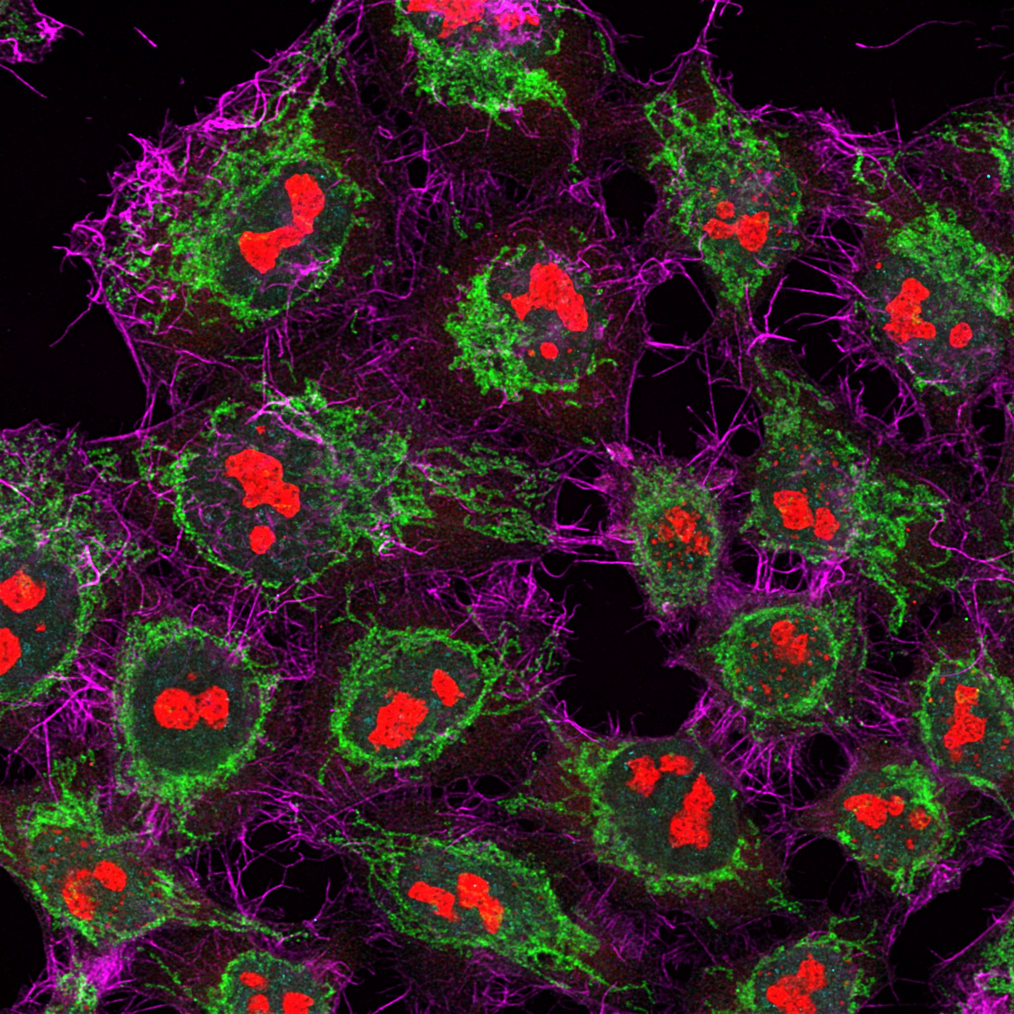 Immunofluorescence of HeLa: PFA-fixed HeLa cells were stained with anti-TOM70 (14528-1-AP) labeled with FlexAble CoraLite® Plus 488 Kit (KFA001, green), anti-GNL3 (67169-1-lg) labeled with FlexAble CoraLite® Plus 555 Kit (KFA042, red) and anti-Actin labeled with FlexAble CoraLite® Plus 647 Kit (KFA043, magenta). Cell nuclei are in cyan.
Confocal images were acquired with a 100x oil objective and post-processed. Images were recorded at the Core Facility Bioimaging at the Biomedical Center, LMU Munich.