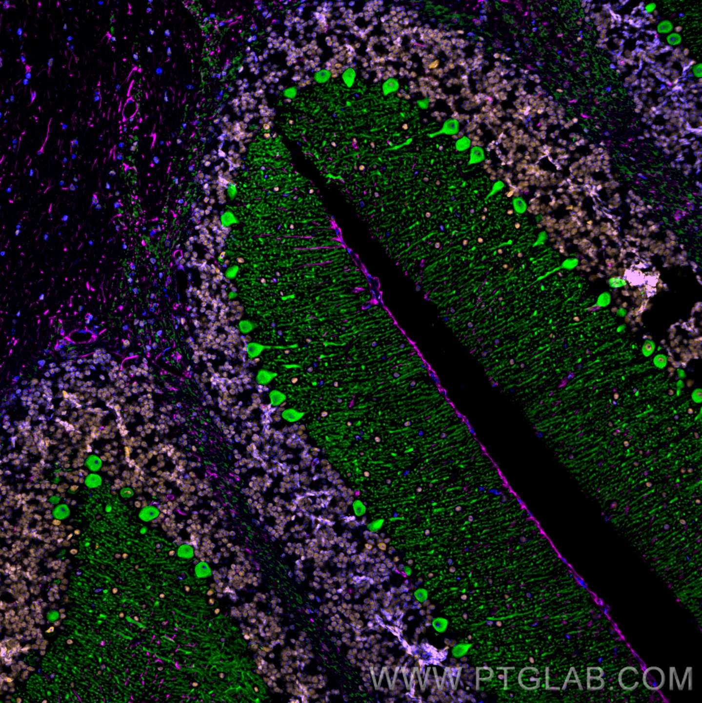 Immunofluorescence of mouse cerebellum: FFPE mouse cerebellum sections were stained with anti-Calbindin antibody (14479-1-AP, green) labeled with FlexAble HRP Antibody Labeling Kit for Rabbit IgG (KFA005) and Tyramide-488, anti-Fus antibody (68262-1-Ig, orange) labeled with FlexAble HRP Antibody Labeling Kit for Mouse IgG1 (KFA025) and Tyramide-555, and anti-GFAP antibody (60190-1-Ig, magenta) labeled with FlexAble HRP Antibody Labeling Kit for Mouse IgG2a (KFA045) and Tyramide-650. Cell nuclei are in blue. 