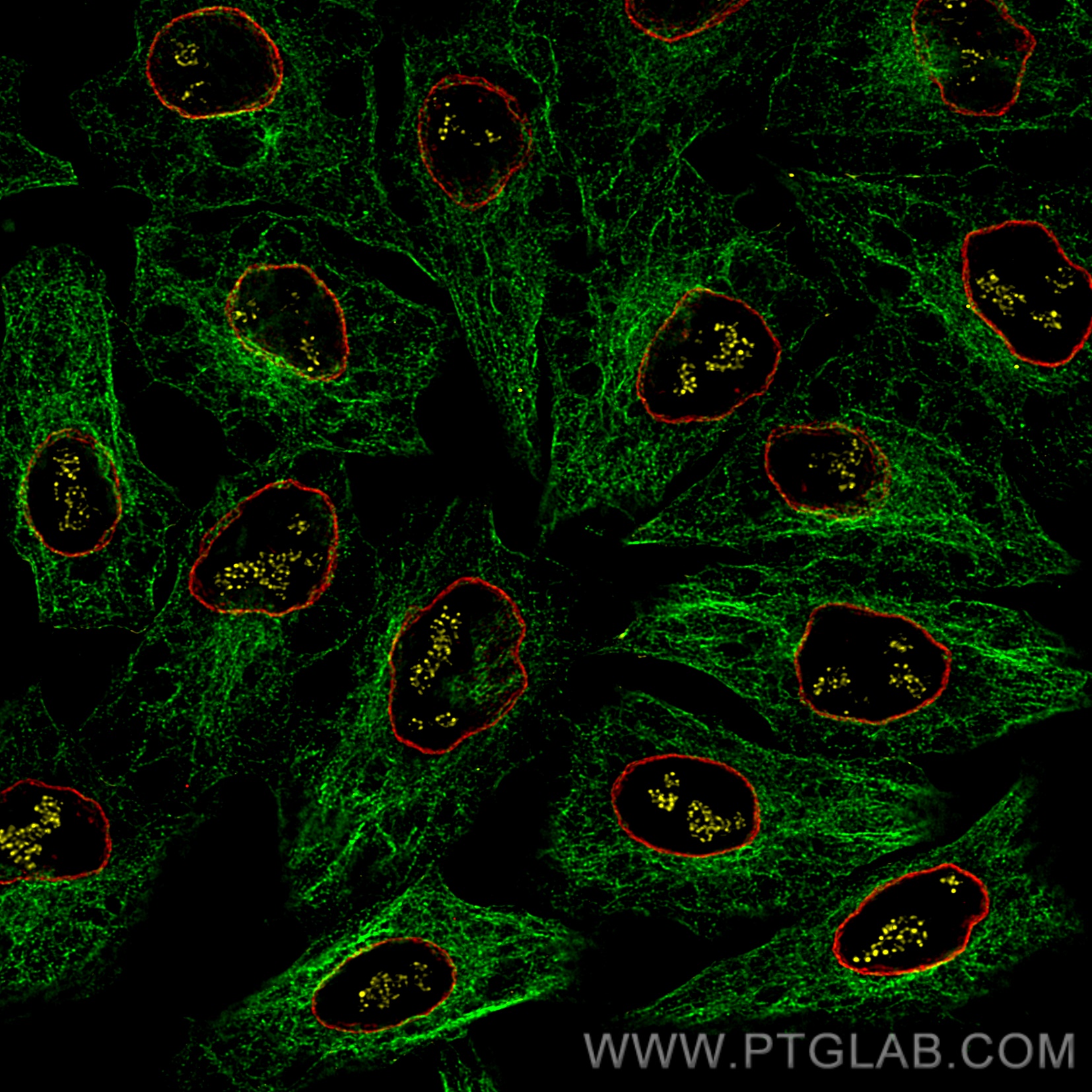 Immunofluorescence of HeLa: PFA-fixed HeLa cells were stained with anti-Tubulin antibody labeled with FlexAble CoraLite® Plus 488 Kit (KFA061, green), anti-Lamin antibody labeled with FlexAble CoraLite® Plus 555 Kit (KFA062, red) and anti-PAF49 antibody labeled with FlexAble CoraLite® Plus 647 Kit (KFA063, yellow). Confocal images were acquired with a 100x oil objective and post-processed. Images were recorded at the Core Facility Bioimaging at the Biomedical Center, LMU Munich.