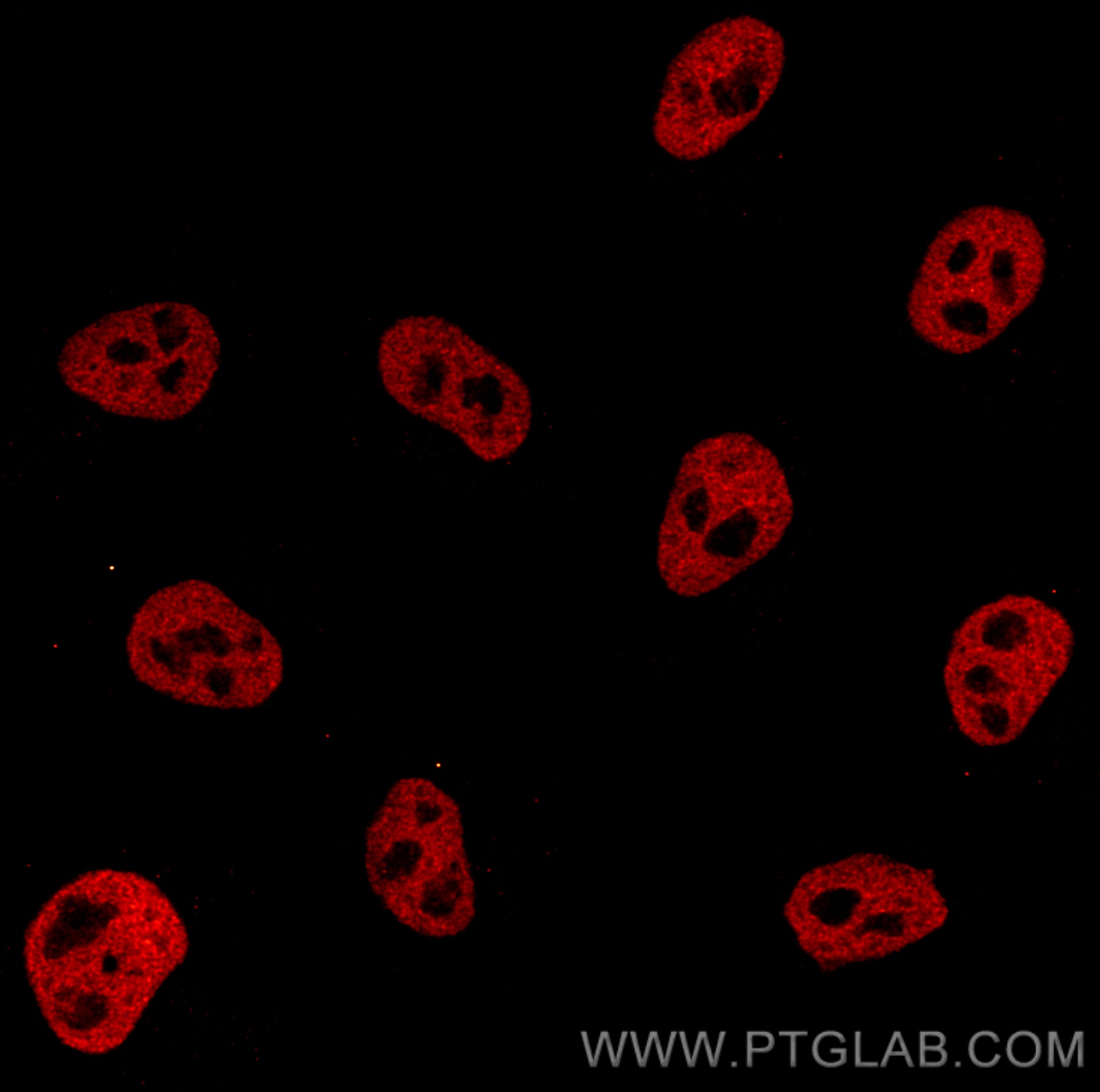 Immunofluorescence of HeLa: PFA-fixed HeLa cells were stained with anti-HDAC2 (67165-1-Ig) labeled with FlexAble CoraLite® Plus 555 Kit (KFA062, red). Confocal images were acquired with a 100x oil objective and post-processed. Images were recorded at the Core Facility Bioimaging at the Biomedical Center, LMU Munich.