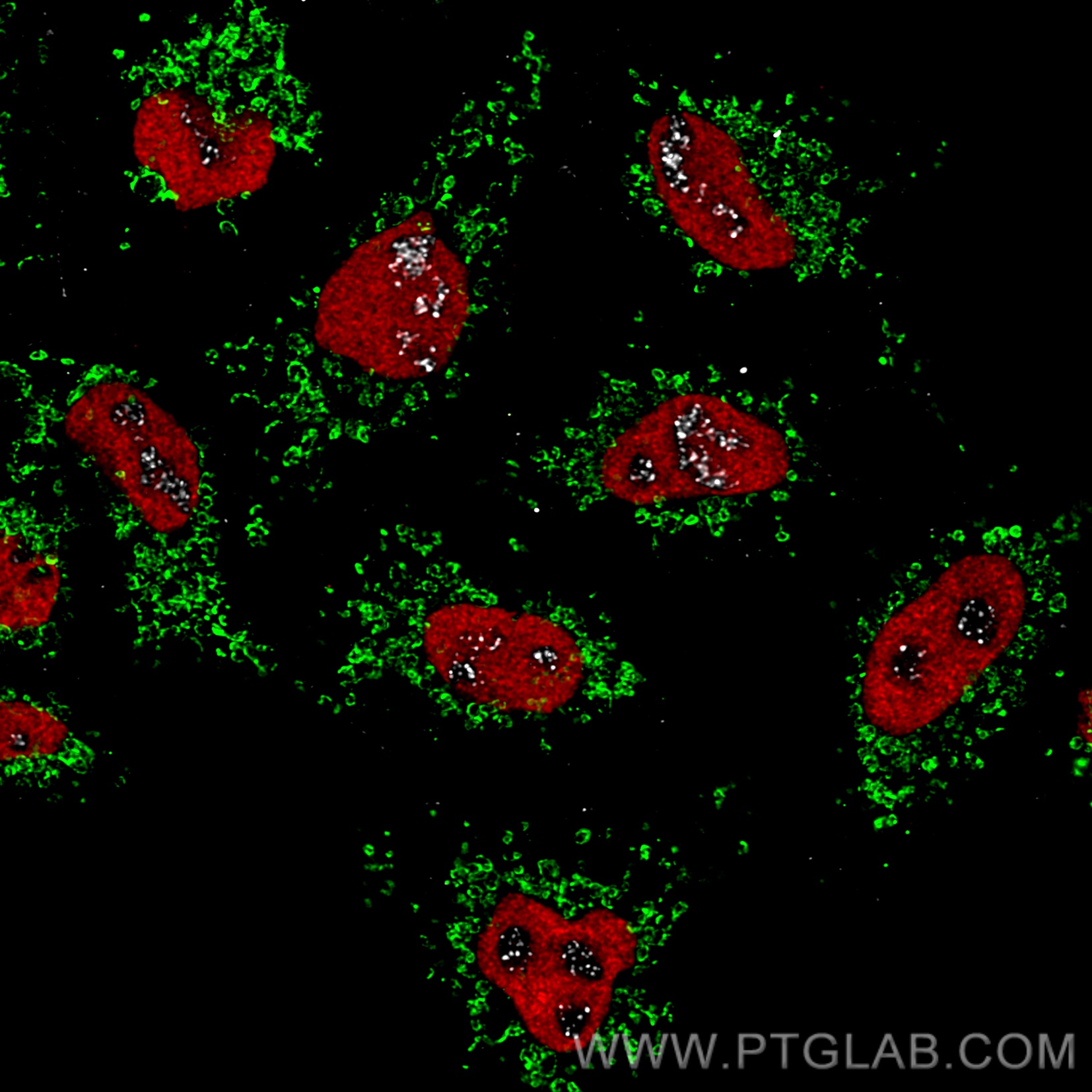 Immunofluorescence of HeLa: PFA-fixed HeLa cells were stained with CoraLite® 488-conjugated Tom20 antibody (CL488-66777, green), anti-HDAC2 (67165-1-Ig) labeled with FlexAble CoraLite® Plus 555 Kit (KFA062, red) and anti- PAF49 antibody labeled with FlexAble ​CoraLite® Plus 647 Kit (KFA063, grey). Confocal images were acquired with a 100x oil objective and post-processed. Images were recorded at the Core Facility Bioimaging at the Biomedical Center, LMU Munich.