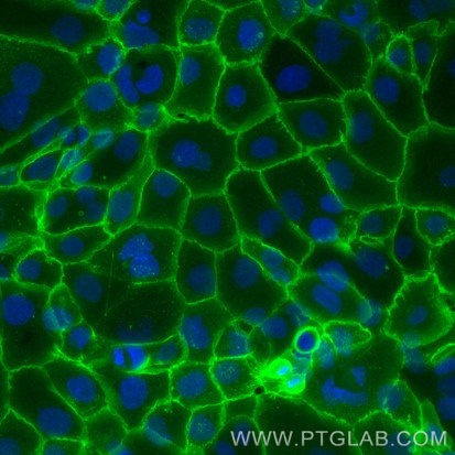 Live A431 cells were immunostained with anti-EGFR (cetuximab biosimilar) labeled with FlexAble CoraLite Plus 488 Antibody Labeling Kit for Human IgG (KFA104). Nuclei are in blue.  Epifluorescence images were acquired with a 20x objective and post-processed.​