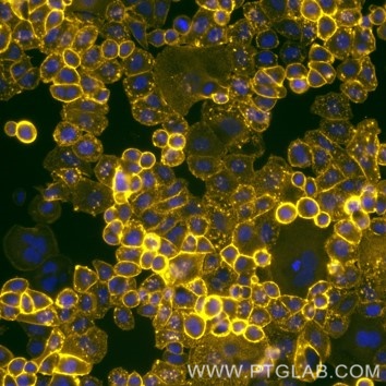 Live SKBR-3 cells immunostained with anti-HER2 (trastuzumab biosimilar) labeled with FlexAble CoraLite Plus 555 Antibody Labeling Kit for Human IgG (KFA105).  Nuclei are in blue.  Epifluorescence images were acquired with a 20x objective and post-processed.