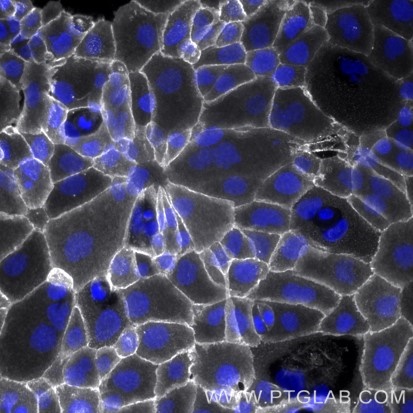 Live A431 cells were immunostained with anti-EGFR (cetuximab biosimilar) labeled with FlexAble CoraLite Plus 750 Antibody Labeling Kit for Human IgG (KFA107). Nuclei are in blue.​  Epifluorescence images were acquired with a 20x objective and post-processed.​