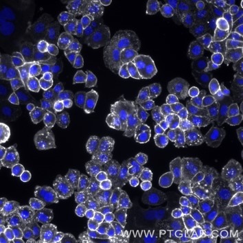 Live SKBR-3 cells immunostained with anti-HER2 (trastuzumab biosimilar) labeled with FlexAble CoraLite Plus 750 Antibody Labeling Kit for Human IgG (KFA107).  Nuclei are in blue.  Epifluorescence images were acquired with a 20x objective and post-processed.