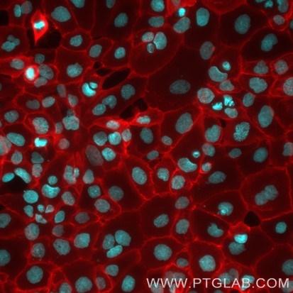 Live A431 cells were immunostained with anti-EGFR (cetuximab biosimilar) labeled with FlexAble Biotin Antibody Labeling Kit for Human IgG (KFA111) and Streptavidin-ATTO594 (red). Nuclei are in cyan.​ Epifluorescence images were acquired with a 20x objective and post-processed.​